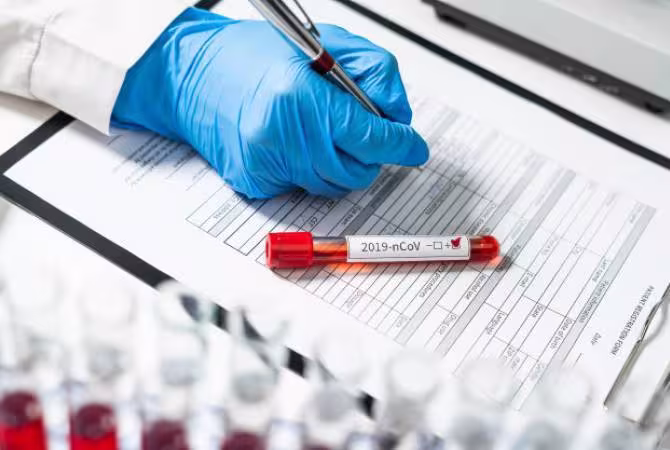 Le nombre de cas de coronavirus en Arménie est de 160 personnes